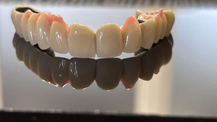 Зуботехнічна лабораторія Gemma.Lab фрезерування цирконію, знімне та не знімне протезування NaviStom