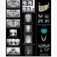 КТ KodakCS 9000 Carestream Dental NaviStom