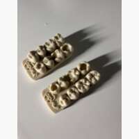 Моделі для відпрацювання практичних навичок реставрації бічної групи зубів NaviStom