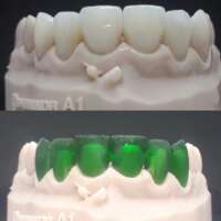 Прессовка E.max LiSi Sagemax NaviStom