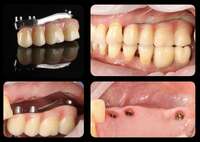 Шукаємо зубного техніка NaviStom