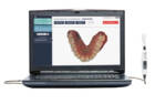 Condor - интраоральный сканер, ноутбук в комплекте | Condor (Бельгия) Новый NaviStom