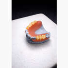 Інжекція та поліровка нейлонових протезів. NaviStom