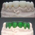 Прессовка E.max LiSi Sagemax NaviStom