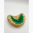 Виготовлення ортодонтичних апаратів та конструкцій NaviStom