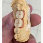 Зуботехнічна лабораторія Deliani Dent, виготовлення всіх видів ортопедії (оснащенна генераторами!) NaviStom