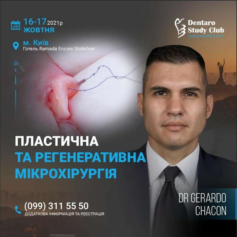 Герардо Чакон NaviStom